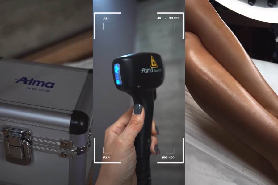Depilacion Laser